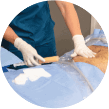 microfat for joint pain
