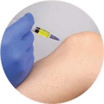 microfat for pain treatment
